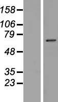 Western blot validation of overexpression lysate (Cat# LY404912) using anti-DDK antibody (Cat# TA50011-100). Left: Cell lysates from un-transfected HEK293T cells; Right: Cell lysates from HEK293T cells transfected with RC222726 using transfection reagent MegaTran 2.0 (Cat# TT210002).