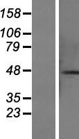 Western blot validation of overexpression lysate (Cat# LY415466) using anti-DDK antibody (Cat# TA50011-100). Left: Cell lysates from un-transfected HEK293T cells; Right: Cell lysates from HEK293T cells transfected with RC219667 using transfection reagent MegaTran 2.0 (Cat# TT210002).