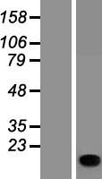 Western blot validation of overexpression lysate (Cat# LY422854) using anti-DDK antibody (Cat# TA50011-100). Left: Cell lysates from un-transfected HEK293T cells; Right: Cell lysates from HEK293T cells transfected with RC224828 using transfection reagent MegaTran 2.0 (Cat# TT210002).