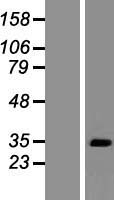 Western blot validation of overexpression lysate (Cat# LY424120) using anti-DDK antibody (Cat# TA50011-100). Left: Cell lysates from un-transfected HEK293T cells; Right: Cell lysates from HEK293T cells transfected with RC222203 using transfection reagent MegaTran 2.0 (Cat# TT210002).