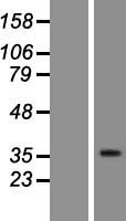 Western blot validation of overexpression lysate (Cat# LY415592) using anti-DDK antibody (Cat# TA50011-100). Left: Cell lysates from un-transfected HEK293T cells; Right: Cell lysates from HEK293T cells transfected with RC221850 using transfection reagent MegaTran 2.0 (Cat# TT210002).
