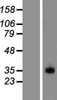Western blot validation of overexpression lysate (Cat# LY405225) using anti-DDK antibody (Cat# TA50011-100). Left: Cell lysates from un-transfected HEK293T cells; Right: Cell lysates from HEK293T cells transfected with RC223589 using transfection reagent MegaTran 2.0 (Cat# TT210002).