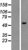 Western blot validation of overexpression lysate (Cat# LY407273) using anti-DDK antibody (Cat# TA50011-100). Left: Cell lysates from un-transfected HEK293T cells; Right: Cell lysates from HEK293T cells transfected with RC217243 using transfection reagent MegaTran 2.0 (Cat# TT210002).