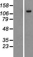 Western blot validation of overexpression lysate (Cat# LY414383) using anti-DDK antibody (Cat# TA50011-100). Left: Cell lysates from un-transfected HEK293T cells; Right: Cell lysates from HEK293T cells transfected with RC220073 using transfection reagent MegaTran 2.0 (Cat# TT210002).