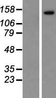 Western blot validation of overexpression lysate (Cat# LY414495) using anti-DDK antibody (Cat# TA50011-100). Left: Cell lysates from un-transfected HEK293T cells; Right: Cell lysates from HEK293T cells transfected with RC218657 using transfection reagent MegaTran 2.0 (Cat# TT210002).