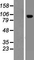 Western blot validation of overexpression lysate (Cat# LY410256) using anti-DDK antibody (Cat# TA50011-100). Left: Cell lysates from un-transfected HEK293T cells; Right: Cell lysates from HEK293T cells transfected with RC222603 using transfection reagent MegaTran 2.0 (Cat# TT210002).