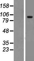 Western blot validation of overexpression lysate (Cat# LY427110) using anti-DDK antibody (Cat# TA50011-100). Left: Cell lysates from un-transfected HEK293T cells; Right: Cell lysates from HEK293T cells transfected with RC226210 using transfection reagent MegaTran 2.0 (Cat# TT210002).