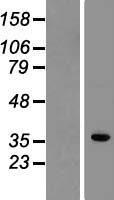 Western blot validation of overexpression lysate (Cat# LY404696) using anti-DDK antibody (Cat# TA50011-100). Left: Cell lysates from un-transfected HEK293T cells; Right: Cell lysates from HEK293T cells transfected with RC220687 using transfection reagent MegaTran 2.0 (Cat# TT210002).