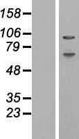 Western blot validation of overexpression lysate (Cat# LY422583) using anti-DDK antibody (Cat# TA50011-100). Left: Cell lysates from un-transfected HEK293T cells; Right: Cell lysates from HEK293T cells transfected with RC219085 using transfection reagent MegaTran 2.0 (Cat# TT210002).