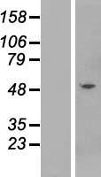 Western blot validation of overexpression lysate (Cat# LY419434) using anti-DDK antibody (Cat# TA50011-100). Left: Cell lysates from un-transfected HEK293T cells; Right: Cell lysates from HEK293T cells transfected with RC215431 using transfection reagent MegaTran 2.0 (Cat# TT210002).