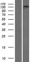 Western blot validation of overexpression lysate (Cat# LY415411) using anti-DDK antibody (Cat# TA50011-100). Left: Cell lysates from un-transfected HEK293T cells; Right: Cell lysates from HEK293T cells transfected with RC211602 using transfection reagent MegaTran 2.0 (Cat# TT210002).