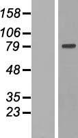 Western blot validation of overexpression lysate (Cat# LY419315) using anti-DDK antibody (Cat# TA50011-100). Left: Cell lysates from un-transfected HEK293T cells; Right: Cell lysates from HEK293T cells transfected with RC219573 using transfection reagent MegaTran 2.0 (Cat# TT210002).
