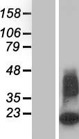 Western blot validation of overexpression lysate (Cat# LY412968) using anti-DDK antibody (Cat# TA50011-100). Left: Cell lysates from un-transfected HEK293T cells; Right: Cell lysates from HEK293T cells transfected with RC223222 using transfection reagent MegaTran 2.0 (Cat# TT210002).