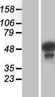 Western blot validation of overexpression lysate (Cat# LY414423) using anti-DDK antibody (Cat# TA50011-100). Left: Cell lysates from un-transfected HEK293T cells; Right: Cell lysates from HEK293T cells transfected with RC200205 using transfection reagent MegaTran 2.0 (Cat# TT210002).