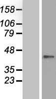 Western blot validation of overexpression lysate (Cat# LY410669) using anti-DDK antibody (Cat# TA50011-100). Left: Cell lysates from un-transfected HEK293T cells; Right: Cell lysates from HEK293T cells transfected with RC223716 using transfection reagent MegaTran 2.0 (Cat# TT210002).
