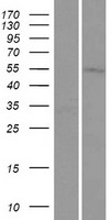 Western blot validation of overexpression lysate (Cat# LY413523) using anti-DDK antibody (Cat# TA50011-100). Left: Cell lysates from un-transfected HEK293T cells; Right: Cell lysates from HEK293T cells transfected with RC202675 using transfection reagent MegaTran 2.0 (Cat# TT210002).