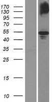 Western blot validation of overexpression lysate (Cat# LY410714) using anti-DDK antibody (Cat# TA50011-100). Left: Cell lysates from un-transfected HEK293T cells; Right: Cell lysates from HEK293T cells transfected with RC205874 using transfection reagent MegaTran 2.0 (Cat# TT210002).