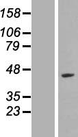 Western blot validation of overexpression lysate (Cat# LY428988) using anti-DDK antibody (Cat# TA50011-100). Left: Cell lysates from un-transfected HEK293T cells; Right: Cell lysates from HEK293T cells transfected with RC226844 using transfection reagent MegaTran 2.0 (Cat# TT210002).