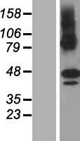 Western blot validation of overexpression lysate (Cat# LY411048) using anti-DDK antibody (Cat# TA50011-100). Left: Cell lysates from un-transfected HEK293T cells; Right: Cell lysates from HEK293T cells transfected with RC204383 using transfection reagent MegaTran 2.0 (Cat# TT210002).