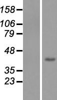Western blot validation of overexpression lysate (Cat# LY407542) using anti-DDK antibody (Cat# TA50011-100). Left: Cell lysates from un-transfected HEK293T cells; Right: Cell lysates from HEK293T cells transfected with RC207066 using transfection reagent MegaTran 2.0 (Cat# TT210002).