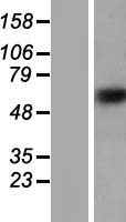 Western blot validation of overexpression lysate (Cat# LY424085) using anti-DDK antibody (Cat# TA50011-100). Left: Cell lysates from un-transfected HEK293T cells; Right: Cell lysates from HEK293T cells transfected with RC209599 using transfection reagent MegaTran 2.0 (Cat# TT210002).