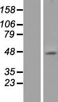 Western blot validation of overexpression lysate (Cat# LY424665) using anti-DDK antibody (Cat# TA50011-100). Left: Cell lysates from un-transfected HEK293T cells; Right: Cell lysates from HEK293T cells transfected with RC218011 using transfection reagent MegaTran 2.0 (Cat# TT210002).