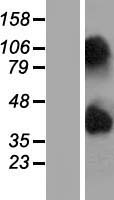 Western blot validation of overexpression lysate (Cat# LY420426) using anti-DDK antibody (Cat# TA50011-100). Left: Cell lysates from un-transfected HEK293T cells; Right: Cell lysates from HEK293T cells transfected with RC214908 using transfection reagent MegaTran 2.0 (Cat# TT210002).