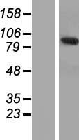 Western blot validation of overexpression lysate (Cat# LY411765) using anti-DDK antibody (Cat# TA50011-100). Left: Cell lysates from un-transfected HEK293T cells; Right: Cell lysates from HEK293T cells transfected with RC219433 using transfection reagent MegaTran 2.0 (Cat# TT210002).