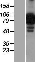 Western blot validation of overexpression lysate (Cat# LY405211) using anti-DDK antibody (Cat# TA50011-100). Left: Cell lysates from un-transfected HEK293T cells; Right: Cell lysates from HEK293T cells transfected with RC205015 using transfection reagent MegaTran 2.0 (Cat# TT210002).