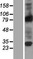 Western blot validation of overexpression lysate (Cat# LY407443) using anti-DDK antibody (Cat# TA50011-100). Left: Cell lysates from un-transfected HEK293T cells; Right: Cell lysates from HEK293T cells transfected with RC204341 using transfection reagent MegaTran 2.0 (Cat# TT210002).