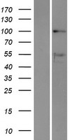 Western blot validation of overexpression lysate (Cat# LY418006) using anti-DDK antibody (Cat# TA50011-100). Left: Cell lysates from un-transfected HEK293T cells; Right: Cell lysates from HEK293T cells transfected with RC210676 using transfection reagent MegaTran 2.0 (Cat# TT210002).