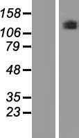 Western blot validation of overexpression lysate (Cat# LY421016) using anti-DDK antibody (Cat# TA50011-100). Left: Cell lysates from un-transfected HEK293T cells; Right: Cell lysates from HEK293T cells transfected with RC221926 using transfection reagent MegaTran 2.0 (Cat# TT210002).