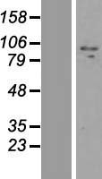 Western blot validation of overexpression lysate (Cat# LY408013) using anti-DDK antibody (Cat# TA50011-100). Left: Cell lysates from un-transfected HEK293T cells; Right: Cell lysates from HEK293T cells transfected with RC224060 using transfection reagent MegaTran 2.0 (Cat# TT210002).