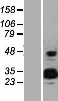 Western blot validation of overexpression lysate (Cat# LY410204) using anti-DDK antibody (Cat# TA50011-100). Left: Cell lysates from un-transfected HEK293T cells; Right: Cell lysates from HEK293T cells transfected with RC202779 using transfection reagent MegaTran 2.0 (Cat# TT210002).