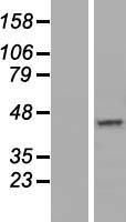 Western blot validation of overexpression lysate (Cat# LY407362) using anti-DDK antibody (Cat# TA50011-100). Left: Cell lysates from un-transfected HEK293T cells; Right: Cell lysates from HEK293T cells transfected with RC205646 using transfection reagent MegaTran 2.0 (Cat# TT210002).