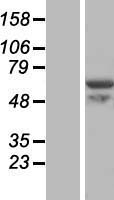 Western blot validation of overexpression lysate (Cat# LY410696) using anti-DDK antibody (Cat# TA50011-100). Left: Cell lysates from un-transfected HEK293T cells; Right: Cell lysates from HEK293T cells transfected with RC201412 using transfection reagent MegaTran 2.0 (Cat# TT210002).