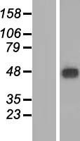 Western blot validation of overexpression lysate (Cat# LY409961) using anti-DDK antibody (Cat# TA50011-100). Left: Cell lysates from un-transfected HEK293T cells; Right: Cell lysates from HEK293T cells transfected with RC202648 using transfection reagent MegaTran 2.0 (Cat# TT210002).