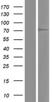 Western blot validation of overexpression lysate (Cat# LY414360) using anti-DDK antibody (Cat# TA50011-100). Left: Cell lysates from un-transfected HEK293T cells; Right: Cell lysates from HEK293T cells transfected with RC220579 using transfection reagent MegaTran 2.0 (Cat# TT210002).