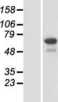 Western blot validation of overexpression lysate (Cat# LY410334) using anti-DDK antibody (Cat# TA50011-100). Left: Cell lysates from un-transfected HEK293T cells; Right: Cell lysates from HEK293T cells transfected with RC224892 using transfection reagent MegaTran 2.0 (Cat# TT210002).