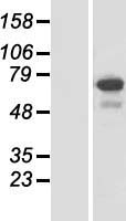 Western blot validation of overexpression lysate (Cat# LY407201) using anti-DDK antibody (Cat# TA50011-100). Left: Cell lysates from un-transfected HEK293T cells; Right: Cell lysates from HEK293T cells transfected with RC219712 using transfection reagent MegaTran 2.0 (Cat# TT210002).