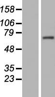 Western blot validation of overexpression lysate (Cat# LY406369) using anti-DDK antibody (Cat# TA50011-100). Left: Cell lysates from un-transfected HEK293T cells; Right: Cell lysates from HEK293T cells transfected with RC221322 using transfection reagent MegaTran 2.0 (Cat# TT210002).