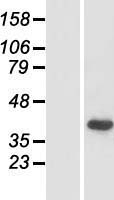 Western blot validation of overexpression lysate (Cat# LY421031) using anti-DDK antibody (Cat# TA50011-100). Left: Cell lysates from un-transfected HEK293T cells; Right: Cell lysates from HEK293T cells transfected with RC212618 using transfection reagent MegaTran 2.0 (Cat# TT210002).
