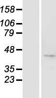 Western blot validation of overexpression lysate (Cat# LY405237) using anti-DDK antibody (Cat# TA50011-100). Left: Cell lysates from un-transfected HEK293T cells; Right: Cell lysates from HEK293T cells transfected with RC205041 using transfection reagent MegaTran 2.0 (Cat# TT210002).