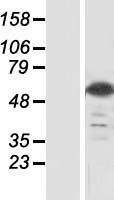 Western blot validation of overexpression lysate (Cat# LY406460) using anti-DDK antibody (Cat# TA50011-100). Left: Cell lysates from un-transfected HEK293T cells; Right: Cell lysates from HEK293T cells transfected with RC209102 using transfection reagent MegaTran 2.0 (Cat# TT210002).