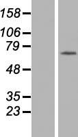 Western blot validation of overexpression lysate (Cat# LY409895) using anti-DDK antibody (Cat# TA50011-100). Left: Cell lysates from un-transfected HEK293T cells; Right: Cell lysates from HEK293T cells transfected with RC200972 using transfection reagent MegaTran 2.0 (Cat# TT210002).