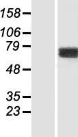 Western blot validation of overexpression lysate (Cat# LY414430) using anti-DDK antibody (Cat# TA50011-100). Left: Cell lysates from un-transfected HEK293T cells; Right: Cell lysates from HEK293T cells transfected with RC204278 using transfection reagent MegaTran 2.0 (Cat# TT210002).