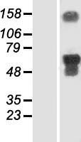 Western blot validation of overexpression lysate (Cat# LY408365) using anti-DDK antibody (Cat# TA50011-100). Left: Cell lysates from un-transfected HEK293T cells; Right: Cell lysates from HEK293T cells transfected with RC218423 using transfection reagent MegaTran 2.0 (Cat# TT210002).