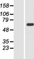 Western blot validation of overexpression lysate (Cat# LY414499) using anti-DDK antibody (Cat# TA50011-100). Left: Cell lysates from un-transfected HEK293T cells; Right: Cell lysates from HEK293T cells transfected with RC205862 using transfection reagent MegaTran 2.0 (Cat# TT210002).