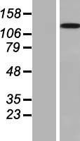 Western blot validation of overexpression lysate (Cat# LY408207) using anti-DDK antibody (Cat# TA50011-100). Left: Cell lysates from un-transfected HEK293T cells; Right: Cell lysates from HEK293T cells transfected with RC206221 using transfection reagent MegaTran 2.0 (Cat# TT210002).