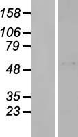 Western blot validation of overexpression lysate (Cat# LY424301) using anti-DDK antibody (Cat# TA50011-100). Left: Cell lysates from un-transfected HEK293T cells; Right: Cell lysates from HEK293T cells transfected with RC209580 using transfection reagent MegaTran 2.0 (Cat# TT210002).